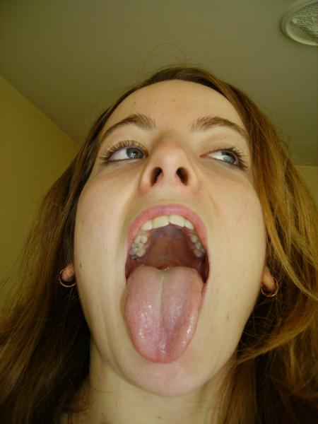 AMAND